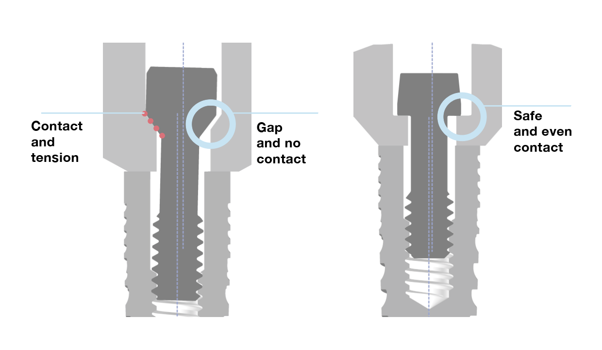 aurumbase screw